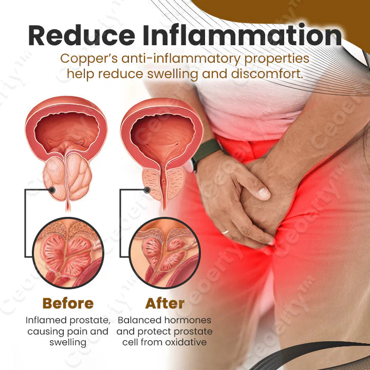 Ceoerty™ ProstaVeno Prostate Care
