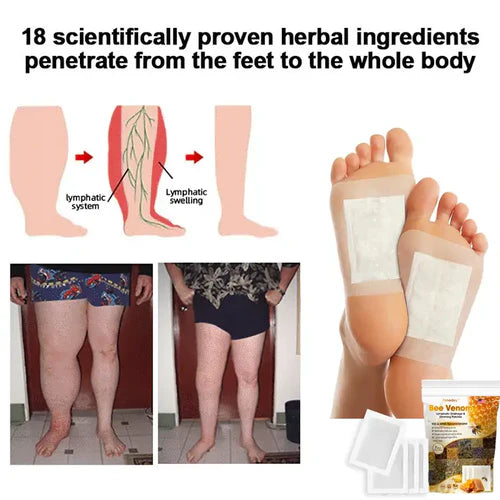 Bee Venom Lymphatic Drainage & Slimming Patches 🌿👣