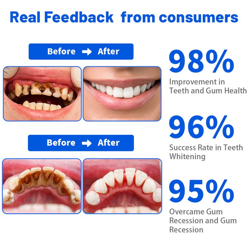 𦷠Dobshow⢠SmartSmile Bee Venom Whitening & Repair Toothpaste (Buy 1 Get 1 Free)