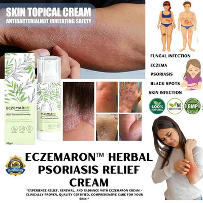 Ecze+ Anti Fungal And Psoriasis Spray Buy 1 Get 1 )