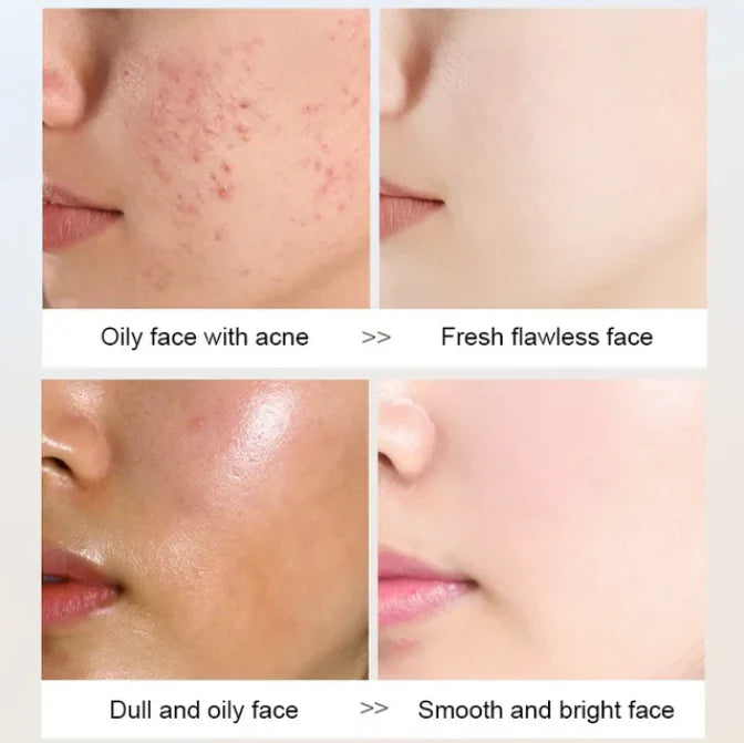 K Beauty SKIN WHITENING FACIAL CLEANSER