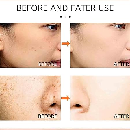 Dermoâ„¢ Saam Renewal Face Cream, Remove Wrinkles, Melasma, Freckles, Skin Aging, Dark skin