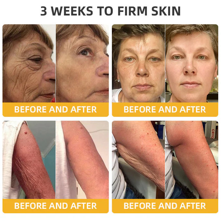 ⚡🐝Flysmus™ BeeLift Anti-Aging Firming Cream,Address Crepe & Sagging(🔥74% Off for a Limited Time!)