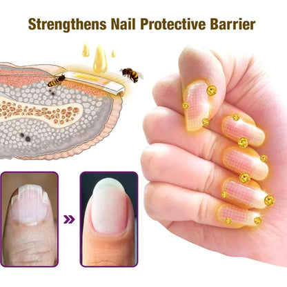 Bee Venom Nail Treatment Serum [Repair Your Nail] Buy 1 Get 1 Free 😍